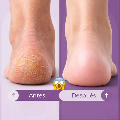 Exfoliante Removedor de Callos