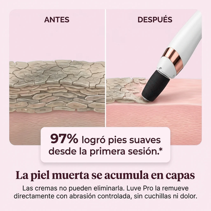 Exfoliante Removedor de Callos