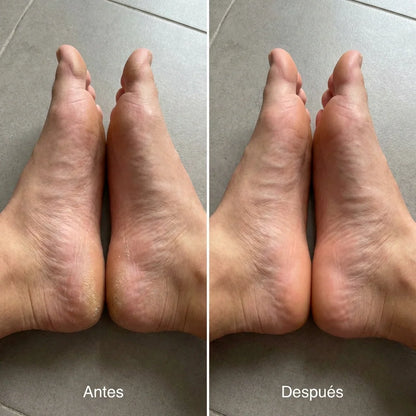 Exfoliante Removedor de Callos